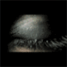 Eyes